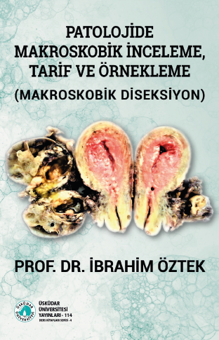 Macroscopic Examination, Description, and Sampling in Pathology (Macroscopic Dissection)